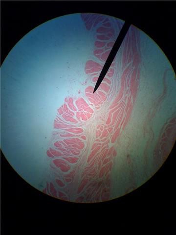 Histology Of Esophagus. esophagus