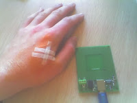 Implantierter RFID-Chip. Quelle: Wikimedia Commons.