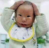 [Chinese baby born with mask face 2[3].jpg]