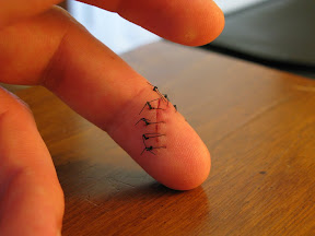 Day Five.  Some of the dried blood is starting to flake out on the underside, oddly enough, right where the stitches are.  I would have expected it to wear out between them first.