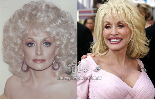 dolly parton antes y despues de la cirugia plastica