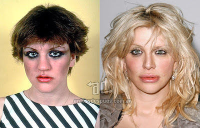 courtney love antes y despues de la cirugia plastica