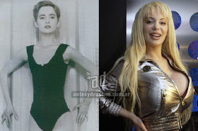 sabrina sabrok antes y despues de la cirugia plastica