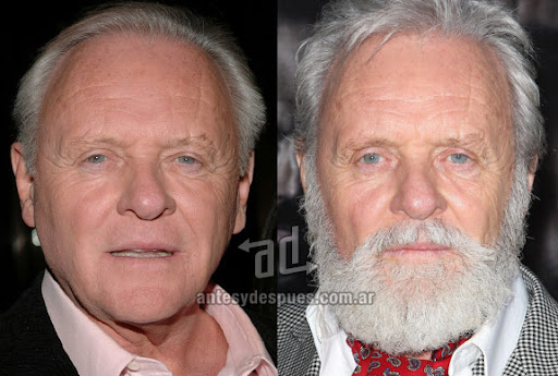 anthony hopkins beard - before and after
