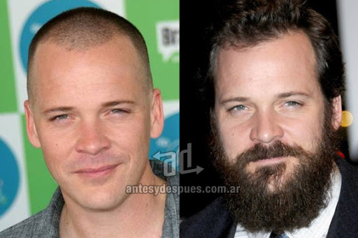 peter sarsgaard beard - before and after