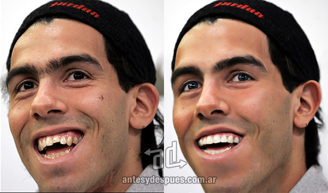 Carlos Tevez Before and after Photoshop