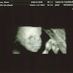 baby_friedman_anatomy_scan_09.jpg