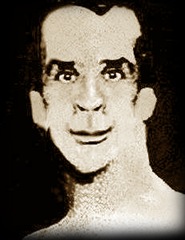 el hombre elefante