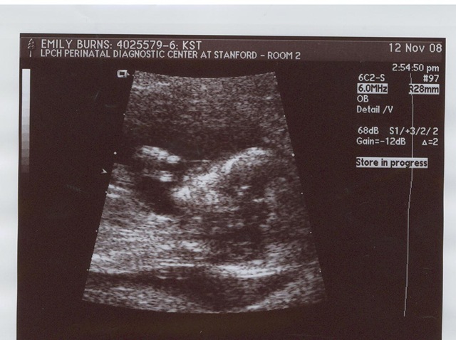 [Baby #2 Ultrasound[3].jpg]