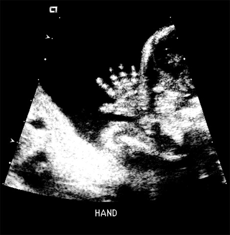 [BabyHand_Prev[1].jpg]