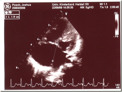 herz_ultraschall_foto herz_ultraschall_foto