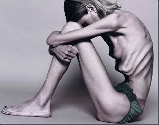 anorexia4lp