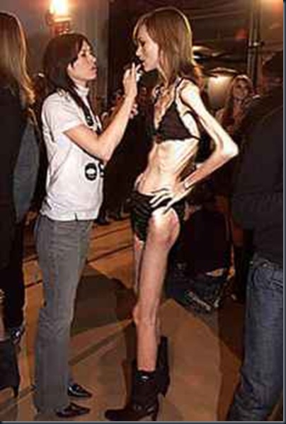 anorexia-3 anorexia-3