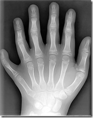6-fingers