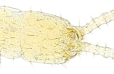 Japygidae mandibles and other mouthparts