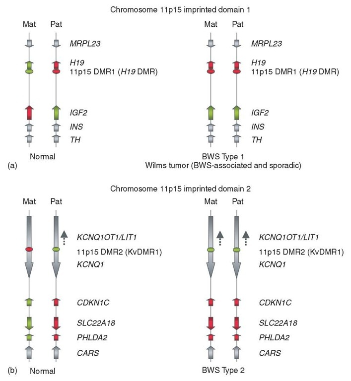  Two clusters of imprinted genes in the BWS-associated region of human chromosome 11p15. (a) The more distally located cluster of imprinted genes includes HI9 and IGF2. (b) The more proximally located cluster includes CDKNIC and several other imprinted genes. The red shading indicates lack of expression; green shading indicates active transcription. Gray shading indicates either lack of imprinting, weak tissue-specific imprinting or incompletely characterized imprinting. The cis-acting imprinting control elements (DMRs) are shown as ovals, with green indicating lack of CpG methylation and red indicating substantial CpG methylation. Directions of transcription are shown by the arrows. Mat: maternal chromosome; Pat: paternal chromosome. The abnormalities that lead to Type 1 and Type 2 BWS are indicated 