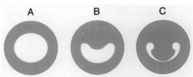  Shape of the pupil in the common bottlenose dolphin at various levels of illumination: (A) loiv illumination, nonconstricted oval pupil; (B) moderate illumination, partially constricted U-shaped pupil: and (C) high illumination, strongly constricted pupil reduced to two pinholes. 