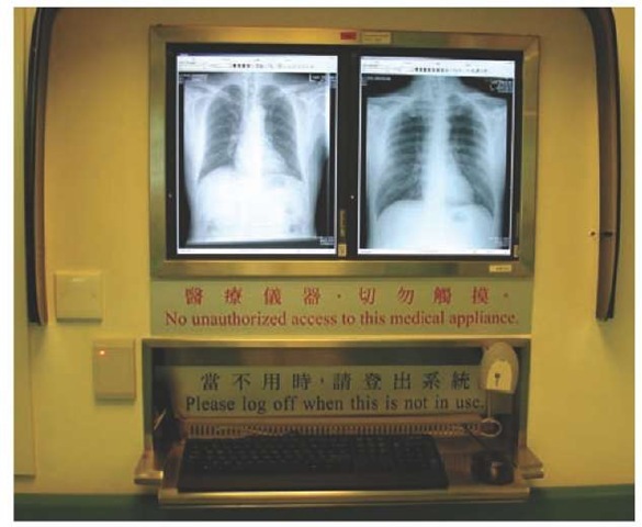 X-ray image viewer in wards 