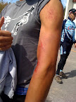  &ndash; When a large, unleashed dog and a sketchy peloton collide on gravel roads.