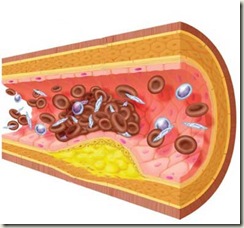 cirugia-sistema-circulatorio-arteria-grasa-obesidad-secuelas