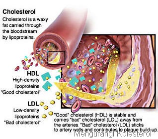 [reduce-cholesterol[5].jpg]
