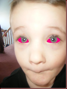 pinkeye 1