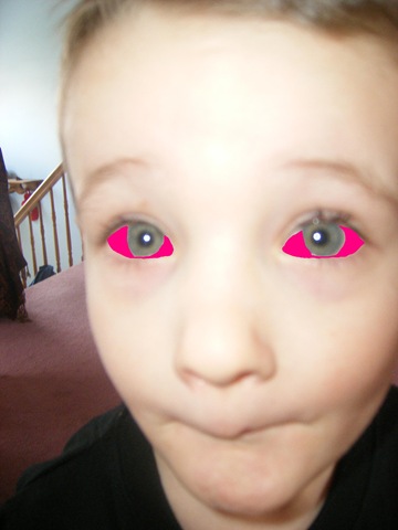 [pinkeye 1[2].jpg]