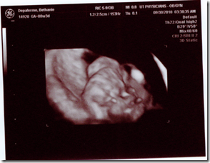 Sonogram 4 (8weeks)