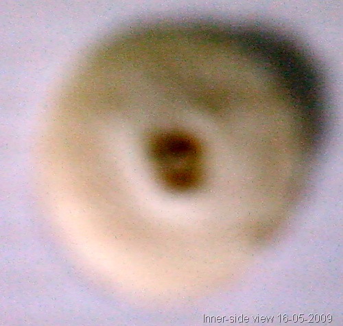 [2009-05-16 - toeCornPeelOff (innerSide)[8].jpg]