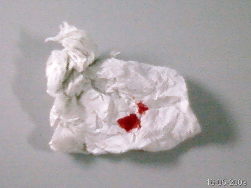 [2009-05-16 - bloodyTissuePaper[4].jpg]