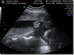 BABY_5 BABY_5