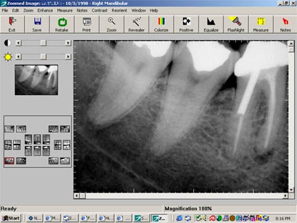 [digital_xray4.jpg]