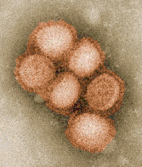influenzaA-h1n1