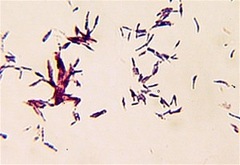 M.chelonae