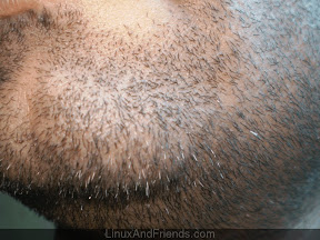 Study the hair growth closely