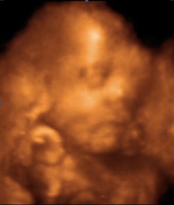 [UC BABY2_1[4].jpg]