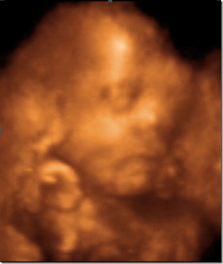 UC BABY2_1