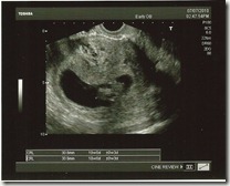 Sonogram 7-7-10 Sonogram 7-7-10
