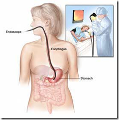 endoscopy