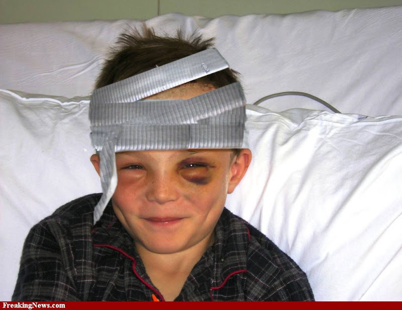 head injury