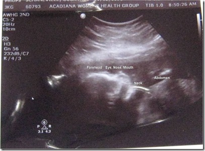 ultrasound1