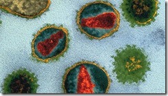 HIV Cure? A recent announcement from the the Walter and Eliza Hall Institute:The answer could be as simple as pumping up your body’s immune system. The potential cure has to do with a hormone called interleukin-7, which “reinvigorates” the body’s immune system when it’s faced with something as hard-core as HIV, or Hepatitis or Tuberculosis. Read the article here: In Australia, Another Hint of HIV Cure | Motherboard