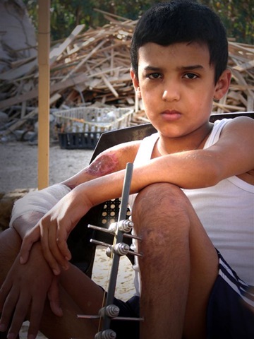 [injured child in Gaza[5].jpg]