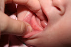 Heidis first tooth is barely visible.