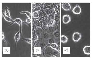 Typical appearances of insect cells in culture by phase contrast microscopy: (A) spindle shaped (fibroblast-like), (B) epithelial shaped, and (C) round.