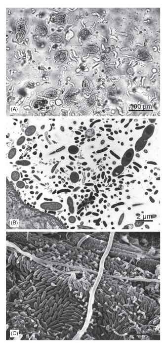 Examples of microbial symbionts in the hindgut of Reticulitermes flavipes (Isoptera: Rhinotermitidae), a wood-feeding lower termite. (A) Preparation of anaerobic protozoa from the hindgut of a worker larva, showing the large hypermastigid flagellate Trichonympha agilis, filled with wood particles, and numerous smaller flagellates (mainly oxymonads, Dinenympha spp.). Differential interference contrast photomicrograph taken by U. Stingl. (B) Transverse section through the peripheral hindgut, showing the diverse bacterial microbiota associated with the thin cuticle of the hindgut wall (bottom left). Transmission electron micrograph provided by J. A. Breznak. (C) Preparation of the hindgut wall, showing the dense colonization of the cuticle by numerous rod-shaped and filamentous bacterial morphotypes. 