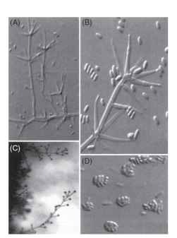 Typical reproductive structures of deuteromycete (imperfect) fungi. (A-D) Wet mount preparation of conidia-generating cells and conidia of Verticillium lecanii, which commonly attacks aphids and whiteflies. The conidia visible as free conidia and conidial clusters in (B) and (D) are the principal infective units. When these come in contact with an insect host, they germinate and penetrate the body, forming a mycelium that colonizes the insect over a period of several days. When conditions are appropriate, typically meaning high relative humidity, hyphae penetrate back out through the cuticle, producing conidiophores, the visible branched structures in these panels (A-C), which form reproductive conidia at their tips. 