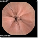 esophagus esophagus