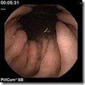 stomach stomach