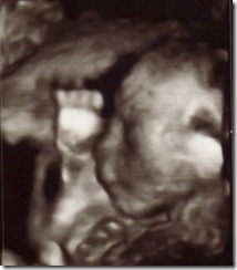 Face 2 at 20 Weeks